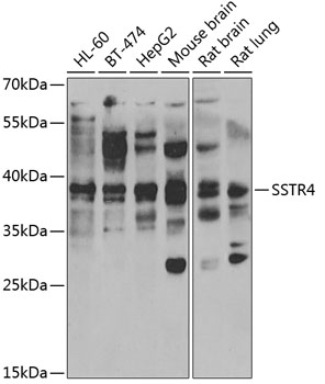 Western blot analysis of extracts of various cell lines using SSTR4 Polyclonal Antibody at 1:1000 dilution.