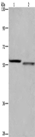 Western Blot analysis of K562 and A431 cell using FRK Polyclonal Antibody at dilution of 1:1200