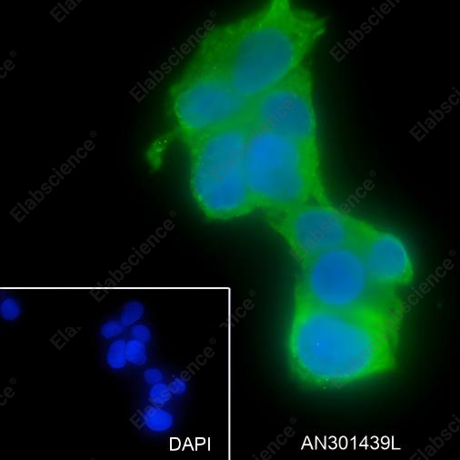 Recombinant ASGR1 Monoclonal Antibody - 5