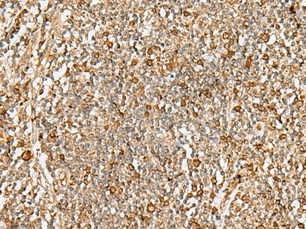 Immunohistochemistry of paraffin-embedded Human tonsil tissue  using DTYMK Polyclonal Antibody at dilution of 1:70(?200)