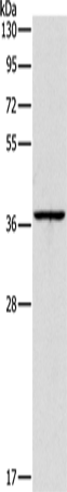 Western Blot analysis of Huvec cell using APOL2 Polyclonal Antibody at dilution of 1:375