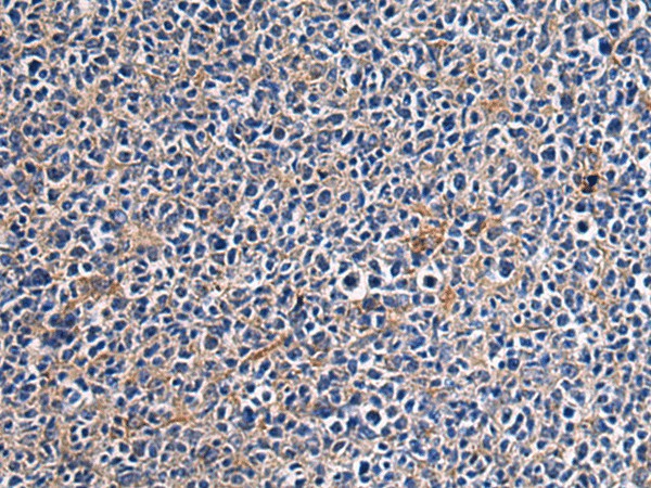 Immunohistochemistry of paraffin-embedded Human tonsil tissue  using CEP89 Polyclonal Antibody at dilution of 1:95(?200)