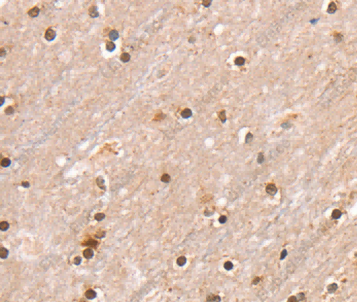 SMARCB1 Polyclonal Antibody - 3