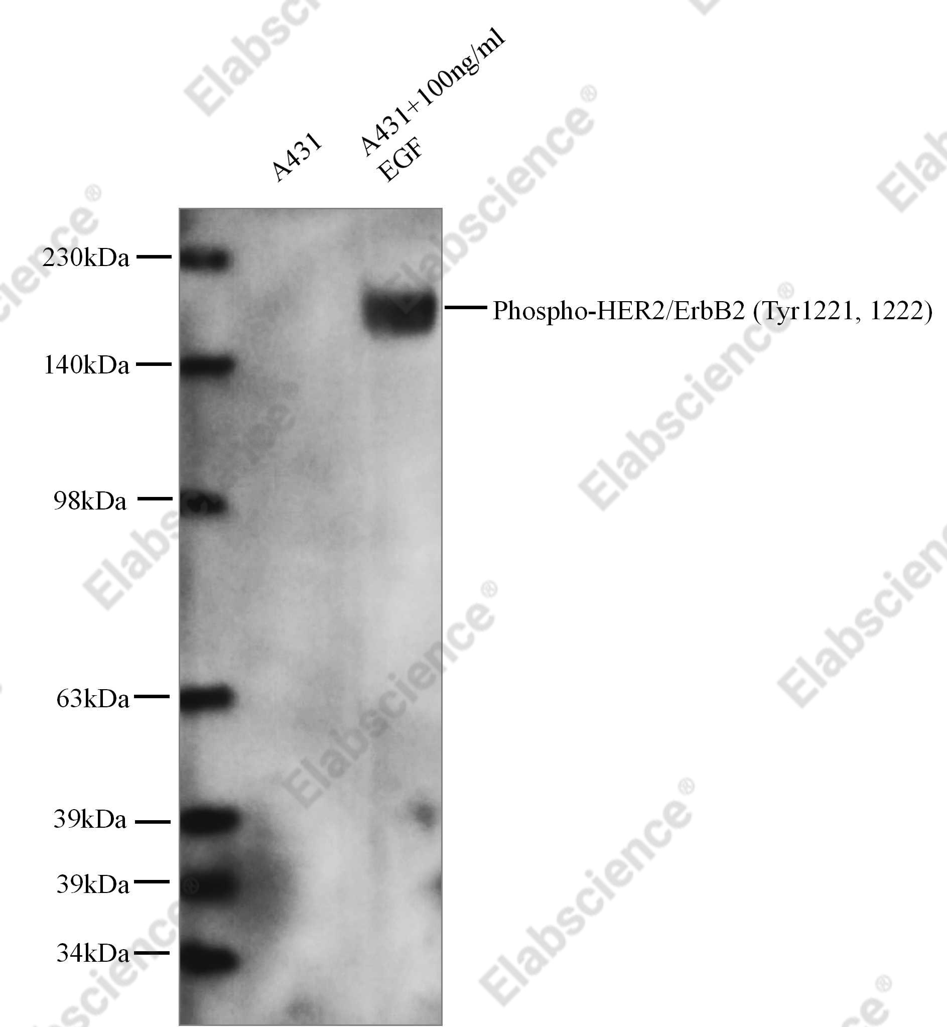 Recombinant Phospho-HER2/ErbB2 (Tyr1221, 1222) Monoclonal Antibody - 1