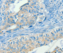 SERPINA9 Polyclonal Antibody - 2