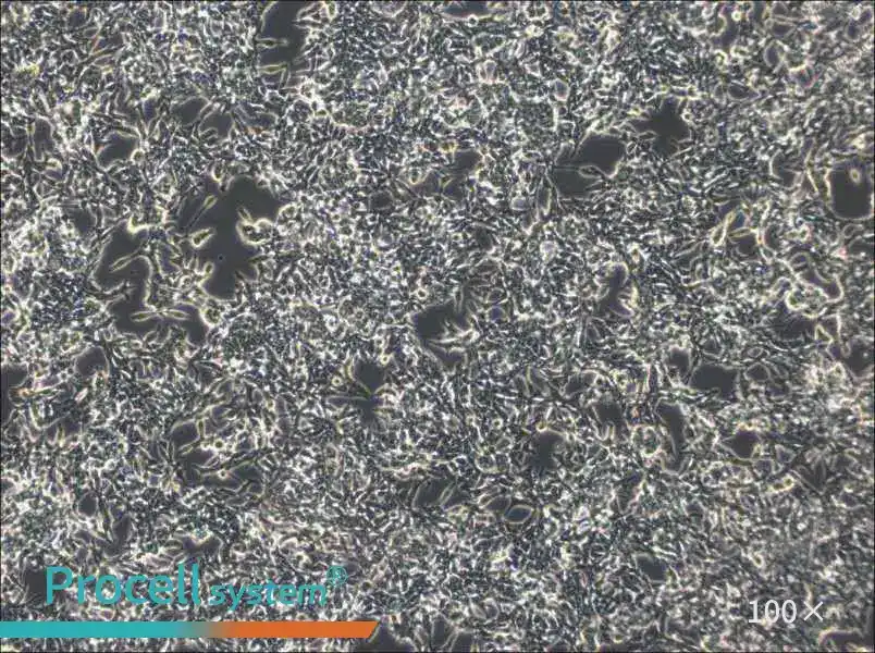 GP2d Cell Complete Medium - 2