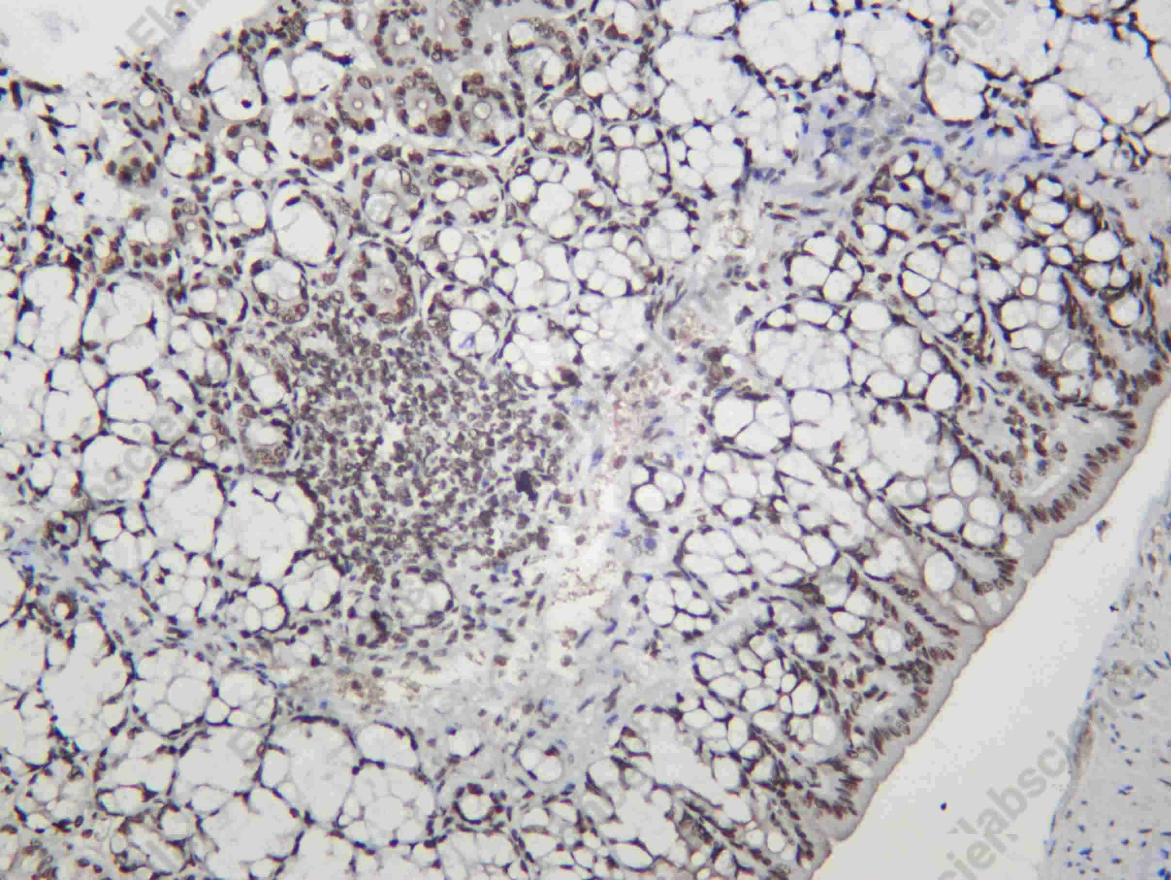 Recombinant ANM7 Monoclonal Antibody - 1