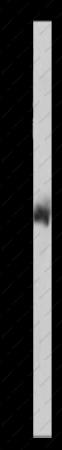 MMP8 Polyclonal Antibody - 1