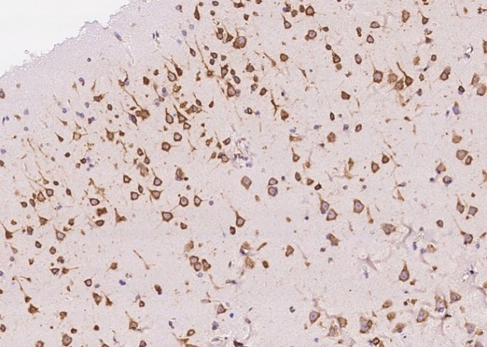 Recombinant AGO2/Argonaute 2/EIF2C2 Monoclonal Antibody - small - 2
