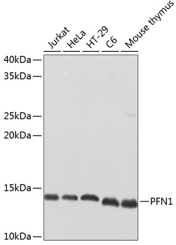 Western blot analysis of extracts of various cell lines using PFN1 Polyclonal Antibody at dilution of 1:500.