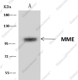 CD10 Monoclonal Antibody - 5