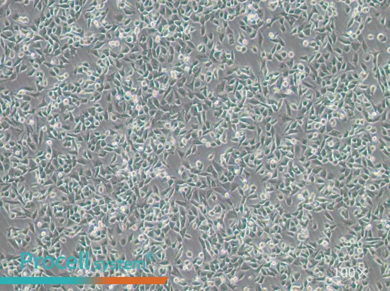 CHP-212 Cell Complete MediumCHP-212 Cell Complete Medium - 2