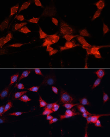 Immunofluorescence analysis of NIH-3T3 cells using DDB1 Polyclonal Antibody at dilution of  1:100 (40x lens). Blue: DAPI for nuclear staining.