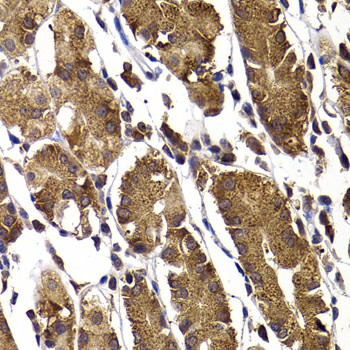 Immunohistochemistry of paraffin-embedded Human stomach using STAMBP Polyclonal Antibody at dilution of 1:100 (40x lens).