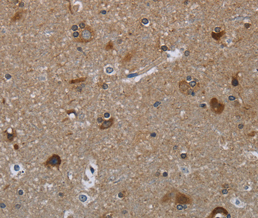 Immunohistochemistry of paraffin-embedded Human brain  tissue using GYS2 Polyclonal Antibody at dilution 1:40