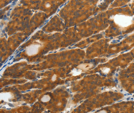 CRP Polyclonal Antibody - 2