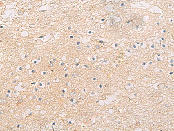 Immunohistochemistry of paraffin-embedded Human brain tissue  using FYCO1 Polyclonal Antibody at dilution of 1:60(?200)