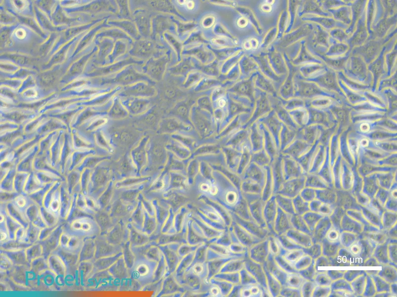 NCTC clone 929 [L cell, L-929] - 5