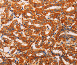 SLC25A4 Polyclonal Antibody - 2