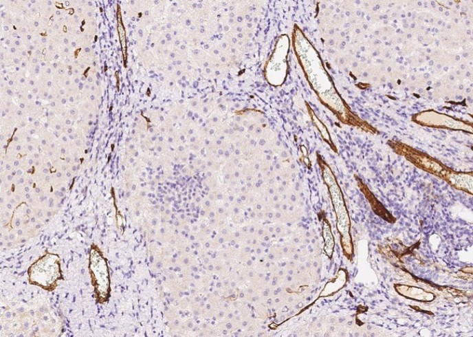 CD34 Monoclonal Antibody - small - 3