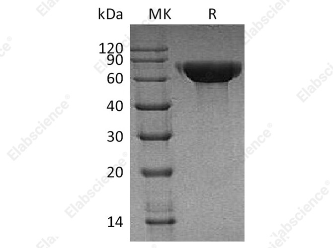Recombinant Human CNDP1 Protein (His Tag) - 1