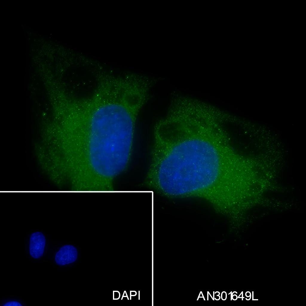 Recombinant ROCK2 Monoclonal Antibody - small - 4