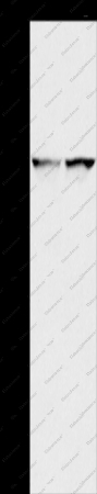 IDH1 Polyclonal Antibody - 1