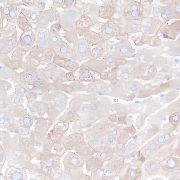 Recombinant FASN Monoclonal Antibody - small - 4