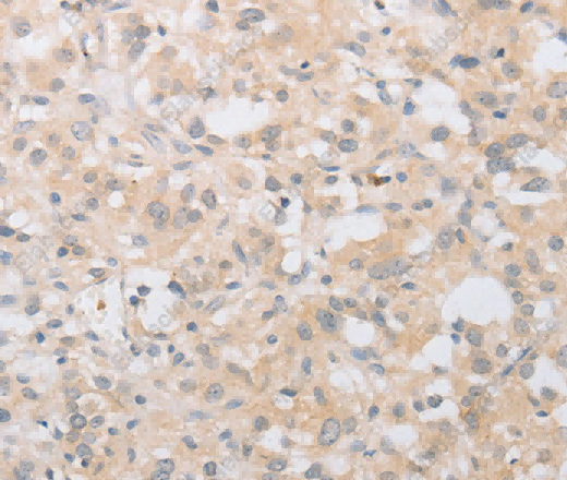 ATG9A Polyclonal Antibody - 3