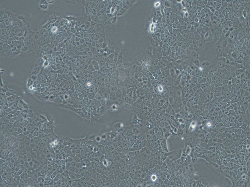 Ca Ski Cell Complete Medium - 3