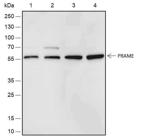 Recombinant PRAME Monoclonal Antibody-searchlist-1