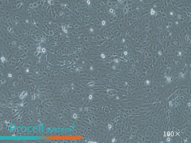 HuCC-T1 Cell Complete MediumHuCC-T1 Cell Complete Medium - 2