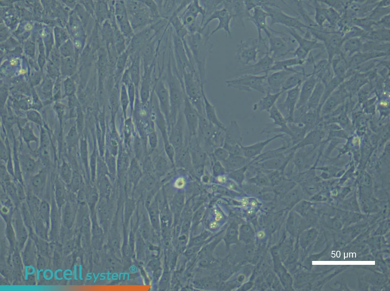 Rat Synovial Fibroblasts - 6