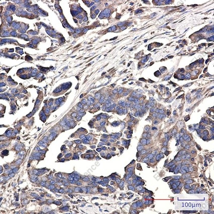 Recombinant WDR1 Monoclonal Antibody - 3