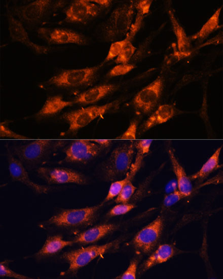 Immunofluorescence analysis of C6 cells using TENM1 Polyclonal Antibody at dilution of  1:100. Blue: DAPI for nuclear staining.