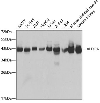 Western blot analysis of extracts of various cell lines using ALDOA Polyclonal Antibody at dilution of 1:1000.