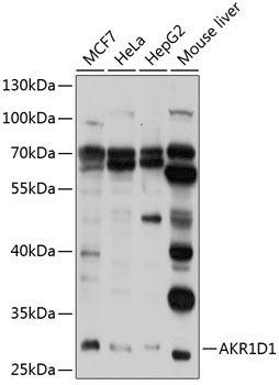 Western blot analysis of extracts of various cell lines using AKR1D1 Polyclonal Antibody at 1:1000 dilution.