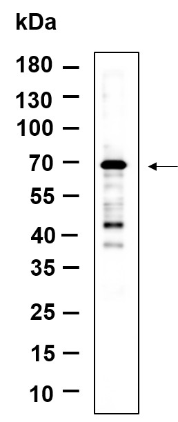 Recombinant NF2 Monoclonal Antibody-searchlist-1