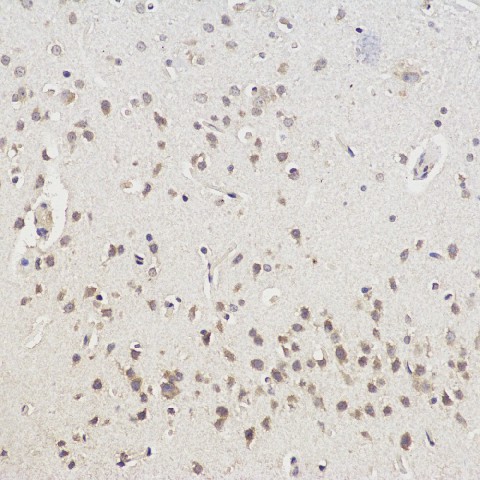 Immunohistochemistry analysis of paraffin-embedded Rat brain  using CHAT Polyclonal Antibody at dilution of 1:100.