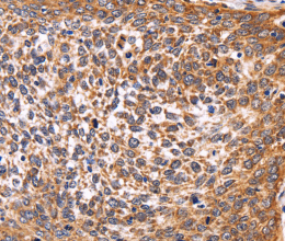 AMIGO2 Polyclonal Antibody - 3
