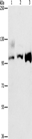 Western Blot analysis of A431, 293T and hela cell using ASCC2 Polyclonal Antibody at dilution of 1:500