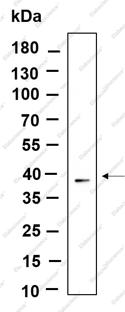 Recombinant Nucleophosmin Monoclonal Antibody - 1
