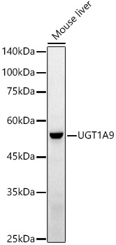 Western blot analysis of extracts of Mouse liver using UGT1A9  Polyclonal Antibody at 1:1000 dilution.