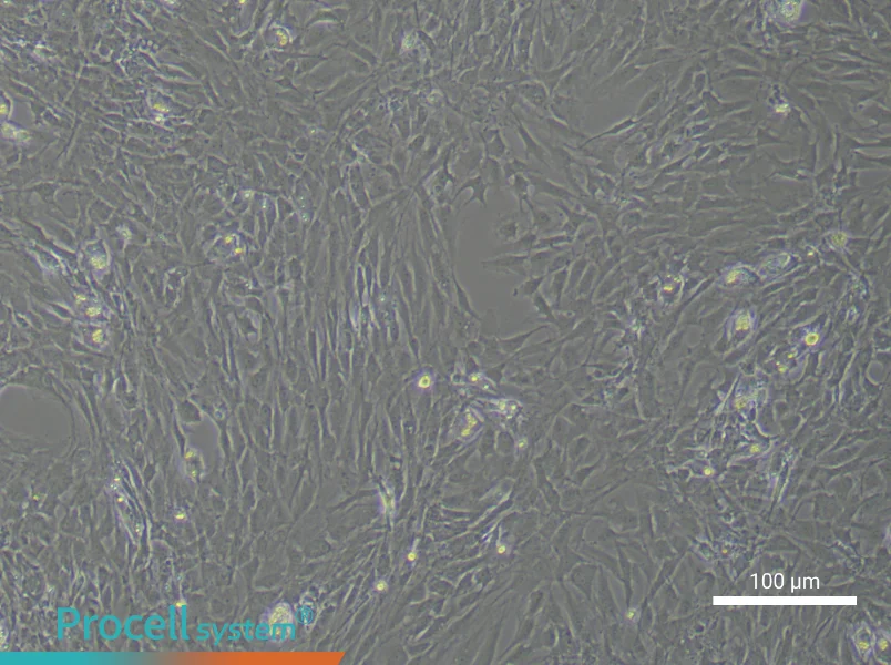 Rat Synovial FibroblastsRat Synovial Fibroblasts - 3