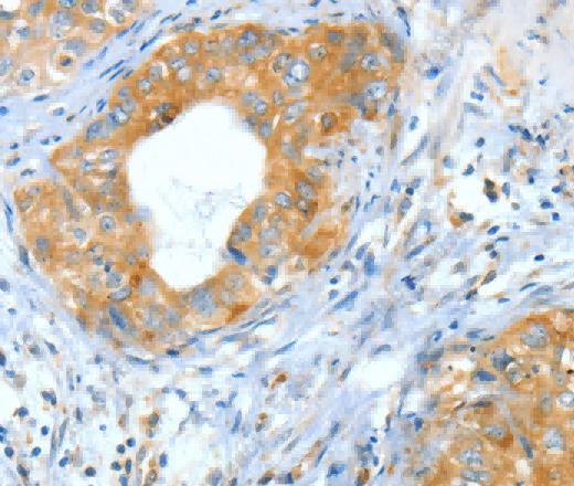 ASNS Polyclonal Antibody - 2
