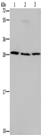 Western Blot analysis of Human fetal liver tissue, 293T and 231 cell using TP53INP1 Polyclonal Antibody at dilution of 1:200