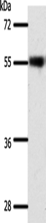 Western Blot analysis of Mouse eye tissue using SLC32A1 Polyclonal Antibody at dilution of 1:500