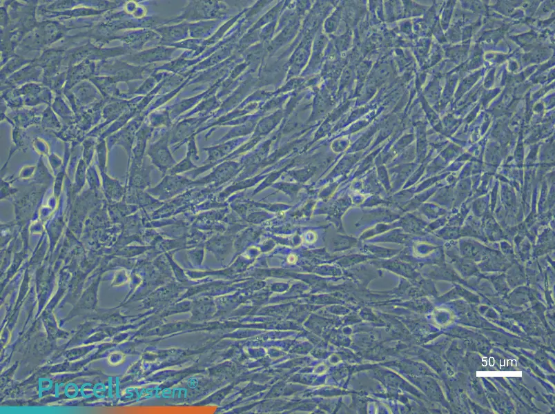 Mouse Lung Fibroblast (Primary cell immortalization) Complete MediumMouse Lung Fibroblast (Primary cell immortalization) Complete Medium - 6