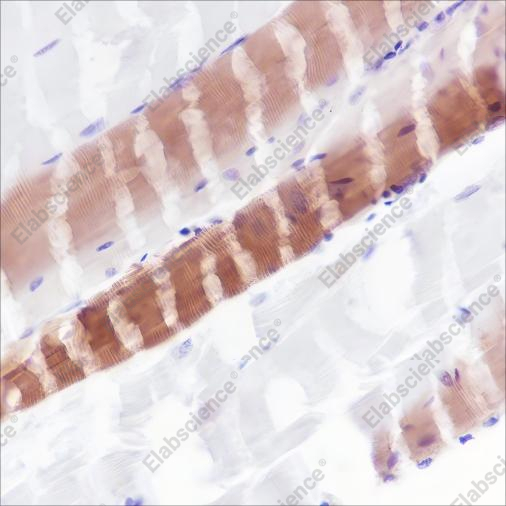 Recombinant Myosin Light Chain 3 Monoclonal Antibody - 6