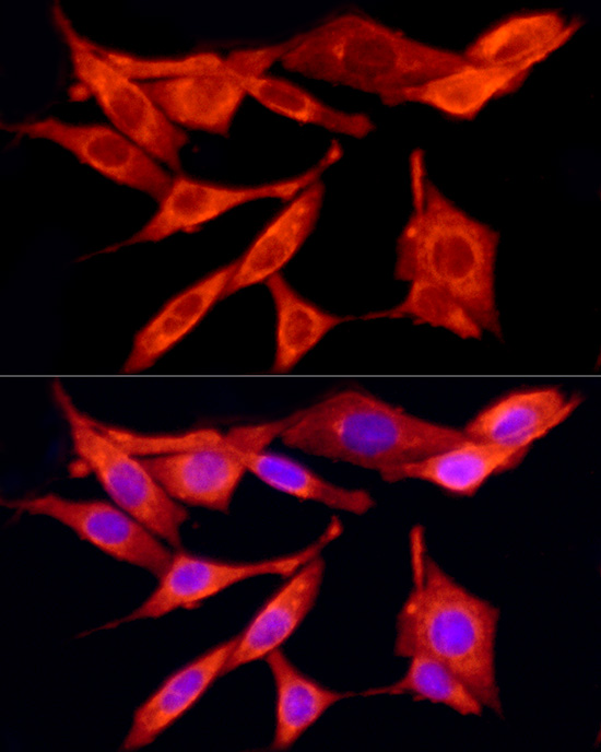 Immunofluorescence analysis of PC-12 cells using TRAF6 Polyclonal antibody at dilution of 1:100 (40x lens). Blue: DAPI for nuclear staining.